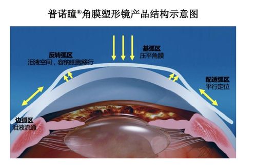眼科新銳愛(ài)博醫(yī)療 技術(shù)先鋒的全球化征程